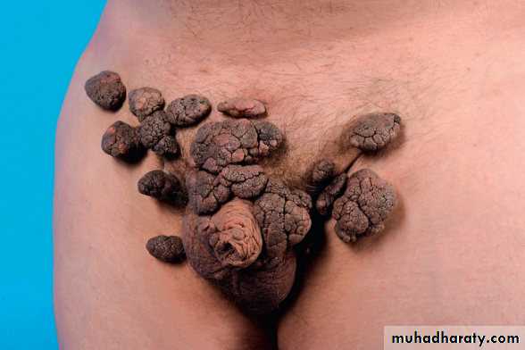Viral infection 1
