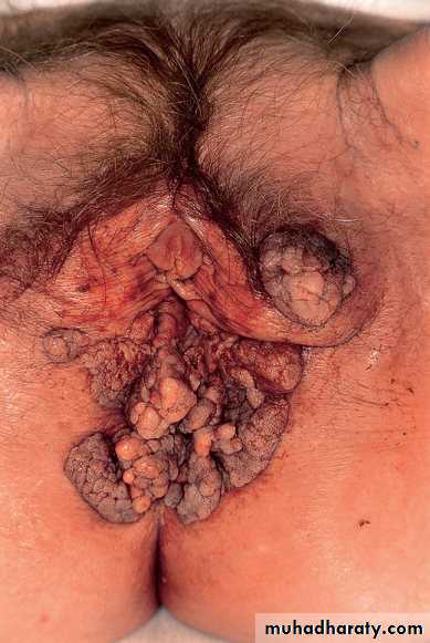 Viral infection 1
