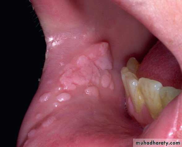 Viral infection 1