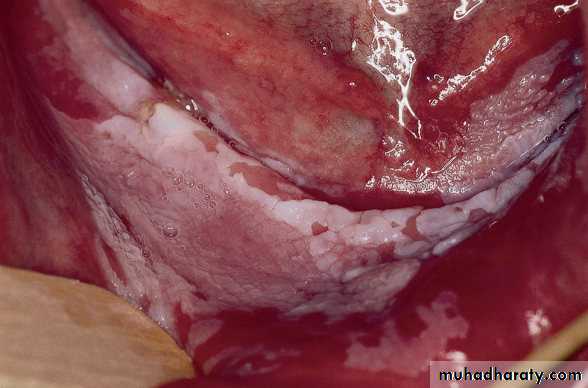 Viral infection 1