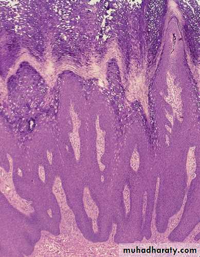 Viral infection 1