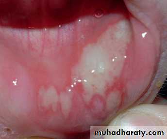 Viral infection 1