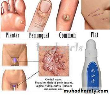 Viral infection 1