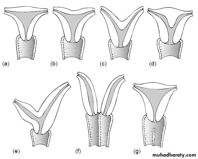 Sexual differentiation