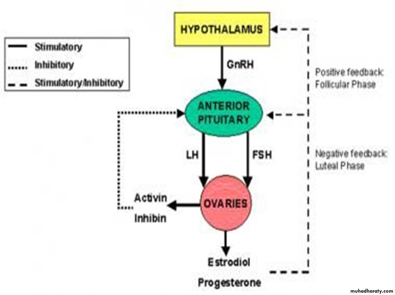 Primary amenorrhea