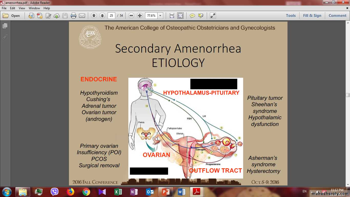 Secondary amenorrhea