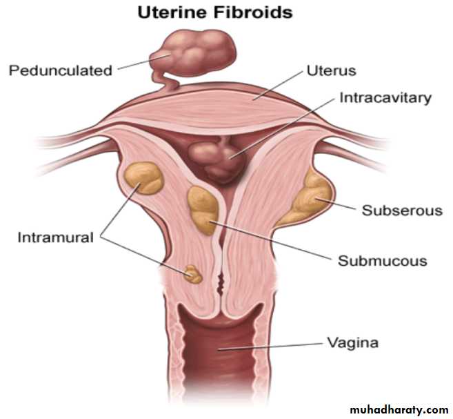 ABNORMAL UTERINE BLEEDING