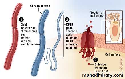Cystic fibrosis