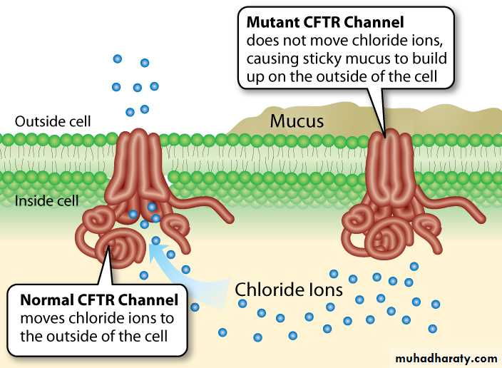 Cystic fibrosis