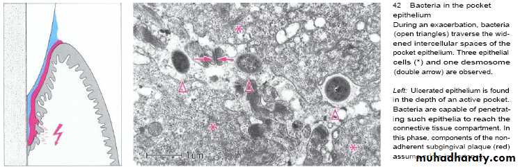 Host defense in the dentogingival area