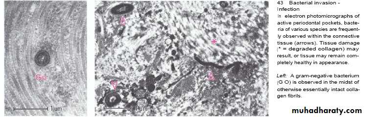 Host defense in the dentogingival area