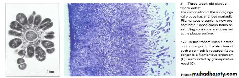 Host defense in the dentogingival area