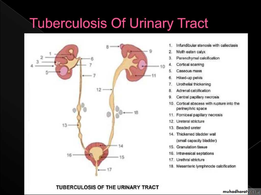 Urinary system 3