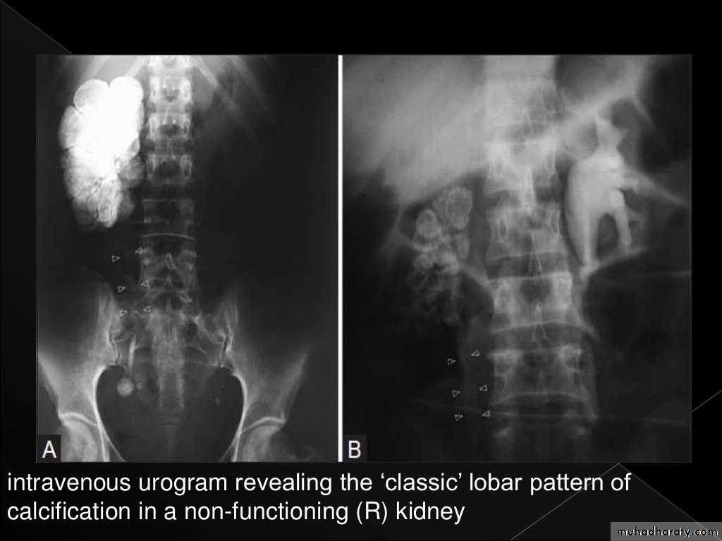 Urinary system 3