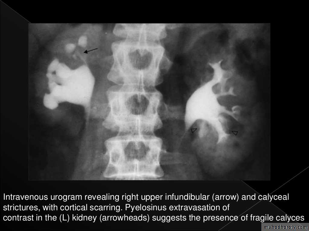 Urinary system 3