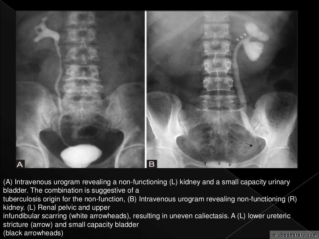Urinary system 3