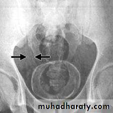 Urinary system 3