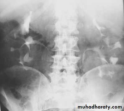 Urinary system 3