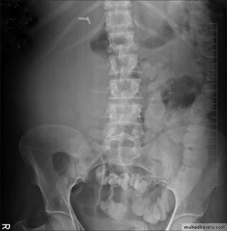Urinary system 3