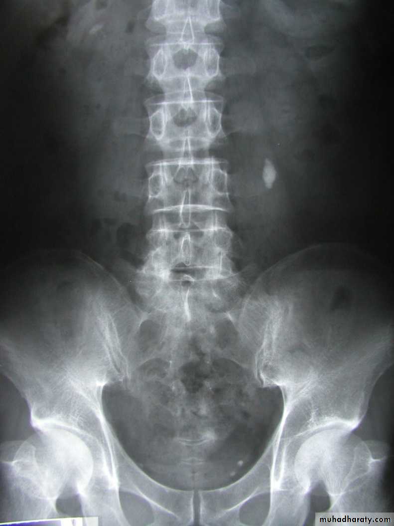 Urinary system 3