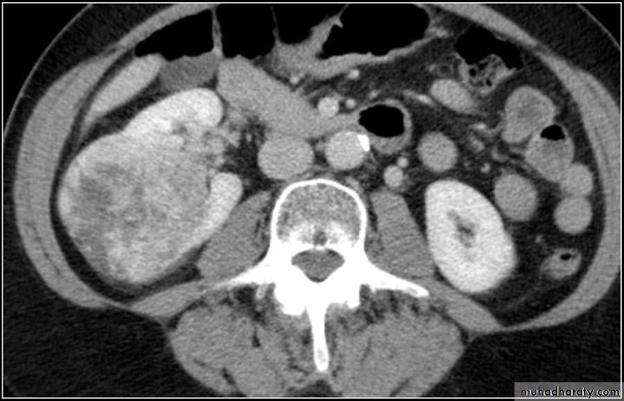 Urinary system 3