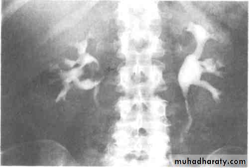 Urinary system 3