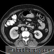 Urinary system 3