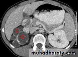 Urinary system 3