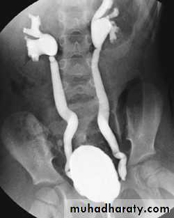 Urinary system 3