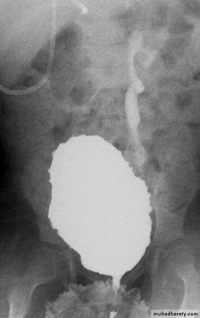 Urinary system 3