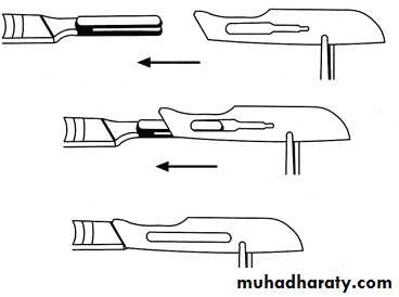 Surgical extraction
