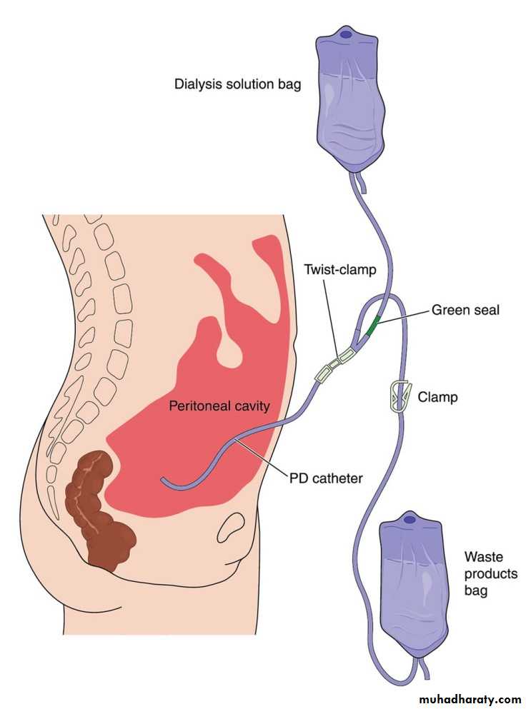 Renal failure