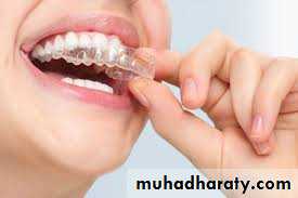 Invisalign in orthodontics
