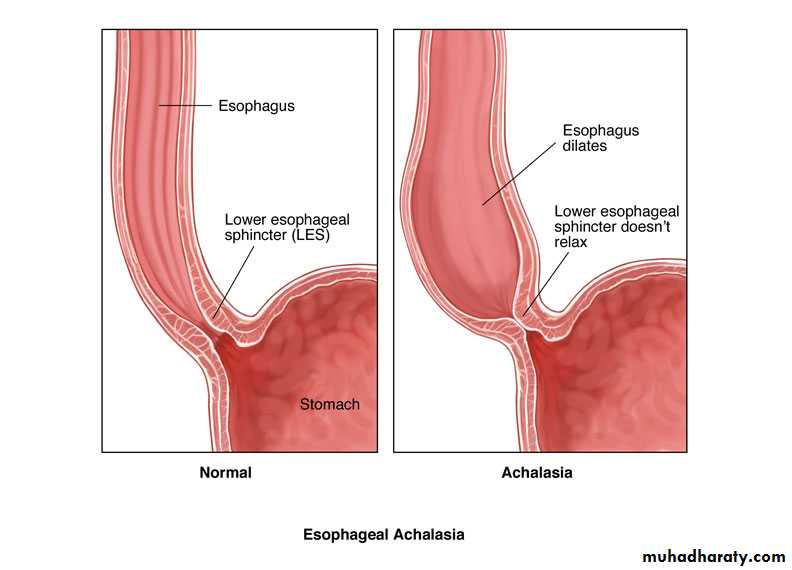 Esophagus