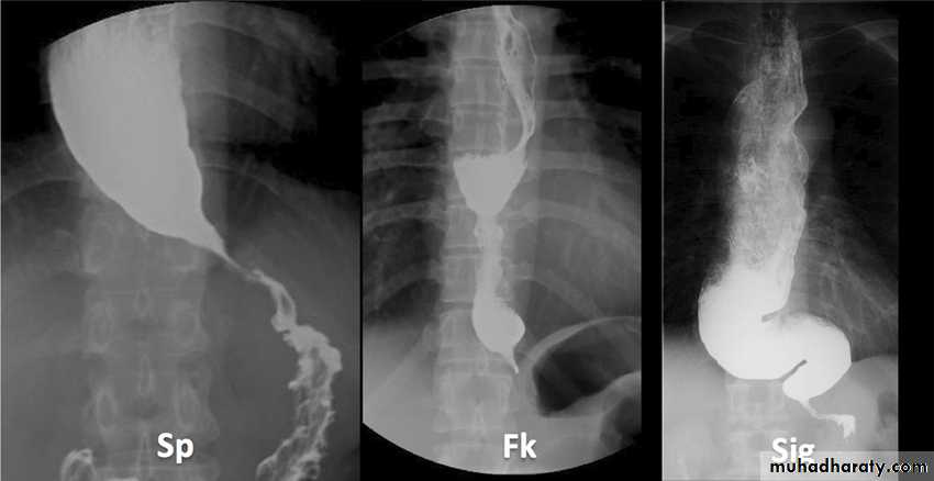 Esophagus
