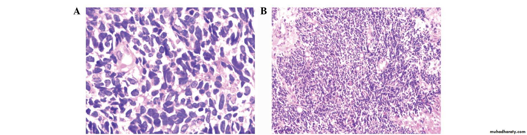 Esophagus