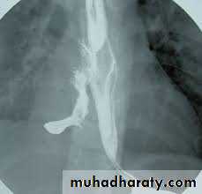 Esophagus