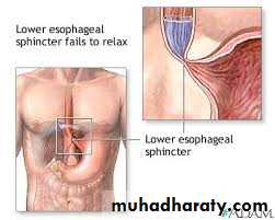 Esophagus