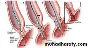 Esophagus