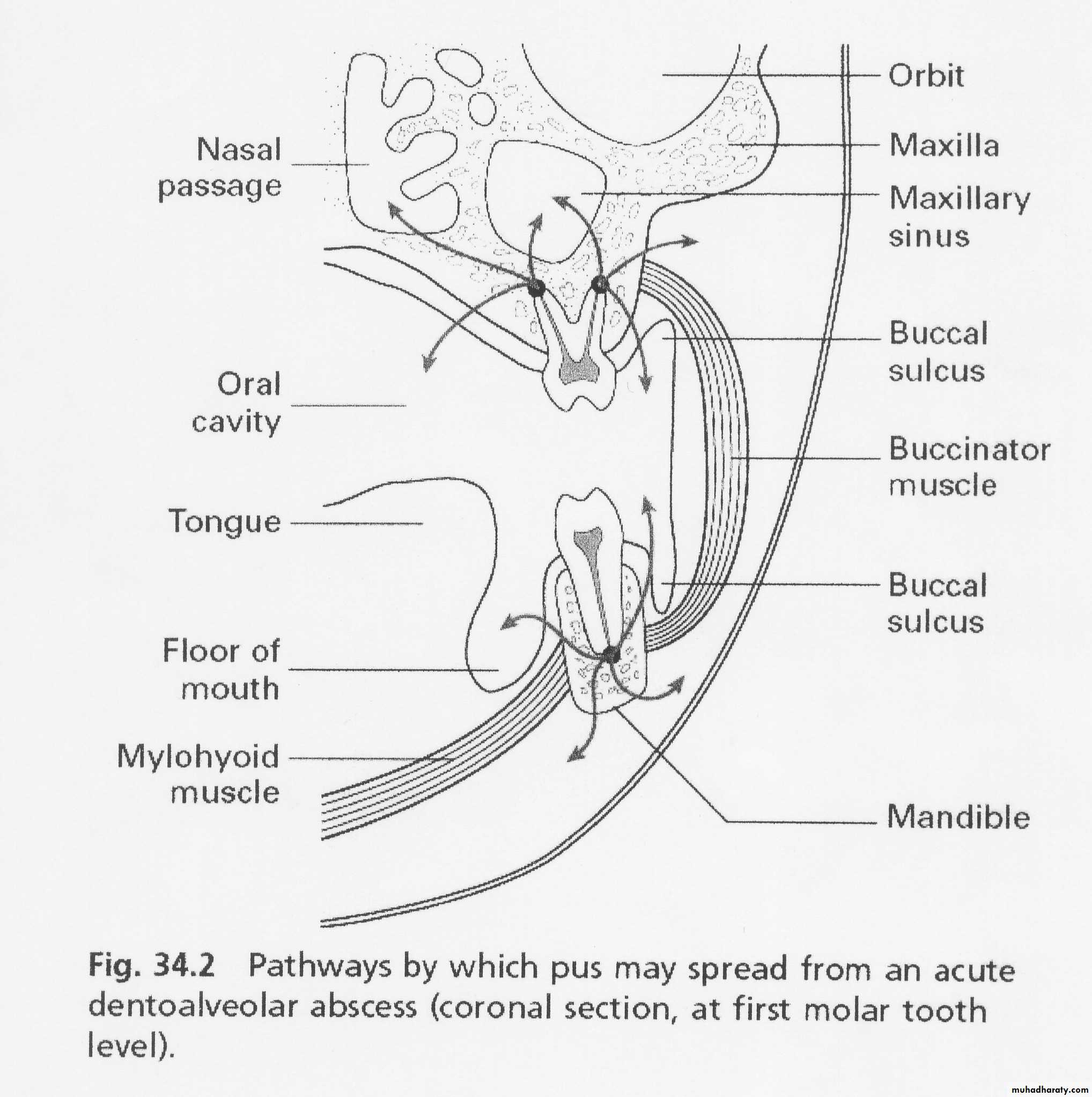 Pulpal diseases and related periapical pathosis part1