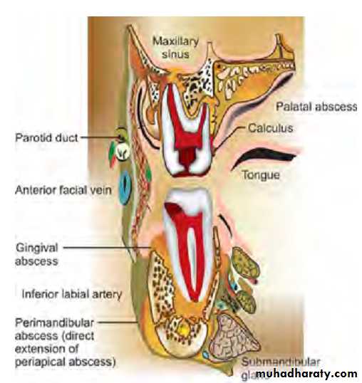 Pulpal diseases and related periapical pathosis part1