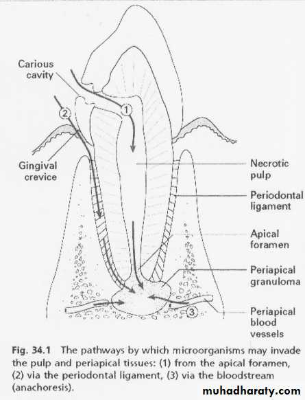 Pulpal diseases and related periapical pathosis part1