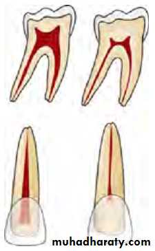 Pulpal diseases and related periapical pathosis part 22