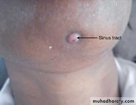 Pulpal diseases and related periapical pathosis part 22