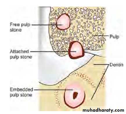 Pulpal diseases and related periapical pathosis part 22