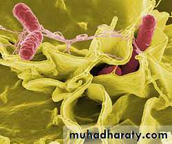 Typhoid Fever