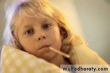 Typhoid Fever