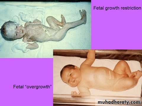 Ultrasound