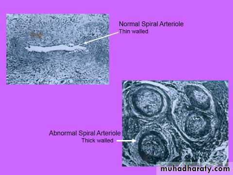 Ultrasound