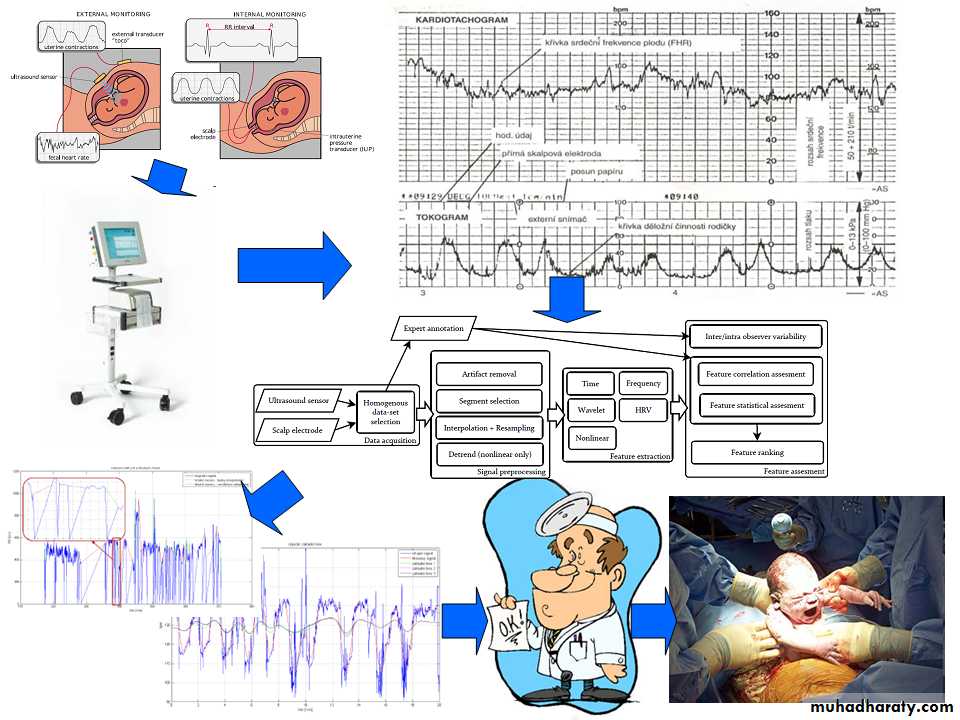 Ultrasound